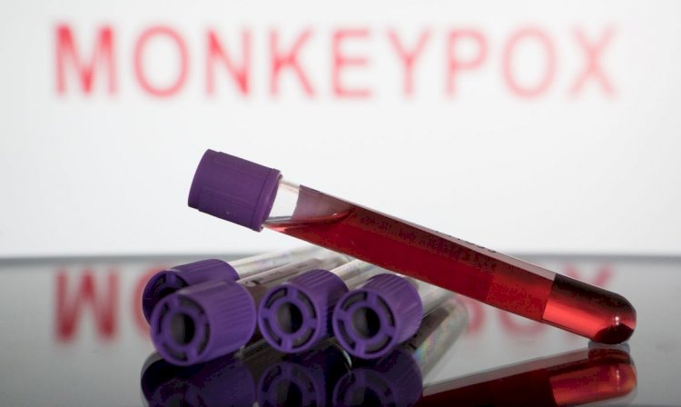 SP registra primeira morte por varíola dos macacos