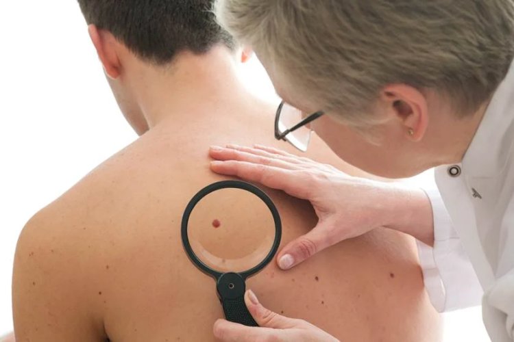 Empresas desenvolvem vacina de RNA contra câncer de pele tipo melanoma